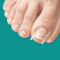 🔥LIMITED OFFER🔥Ingrown Toenail Treatment Corrector Set